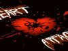 Heart attack