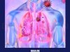 Guia de Doenças Respiratórias - Covid 19 - Agosto 2020
