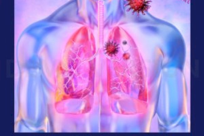 Guia de Doenças Respiratórias - Covid 19 - Agosto 2020